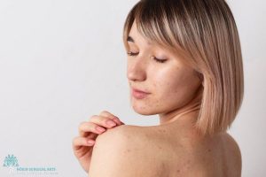 Skin Texture Problems Solved – No Surgery Required in LA, CA