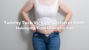 Tummy Tuck Vs. Liposuction or Both: Making the Right Choice For You