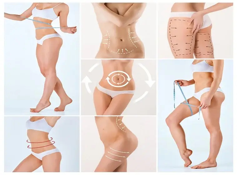 Ideal Candidate for HD Liposuction