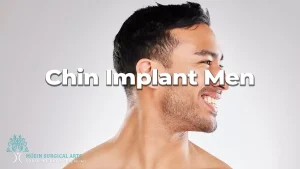 Chin implant men.