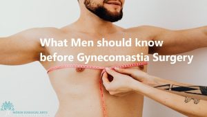 Essential considerations for men undergoing gynecomastia surgery.