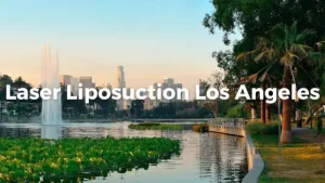 Laser Liposuction in Los Angeles