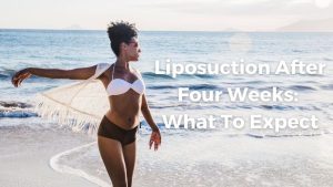 What to expect 4 weeks after liposuction