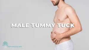 Male Tummy Tuck