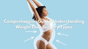 Weight Loss Surgery Types in LA, CA