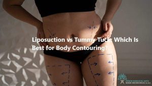 Liposuction vs tummy tuck: Which is best for body contouring?